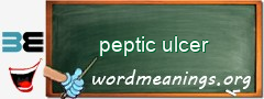 WordMeaning blackboard for peptic ulcer